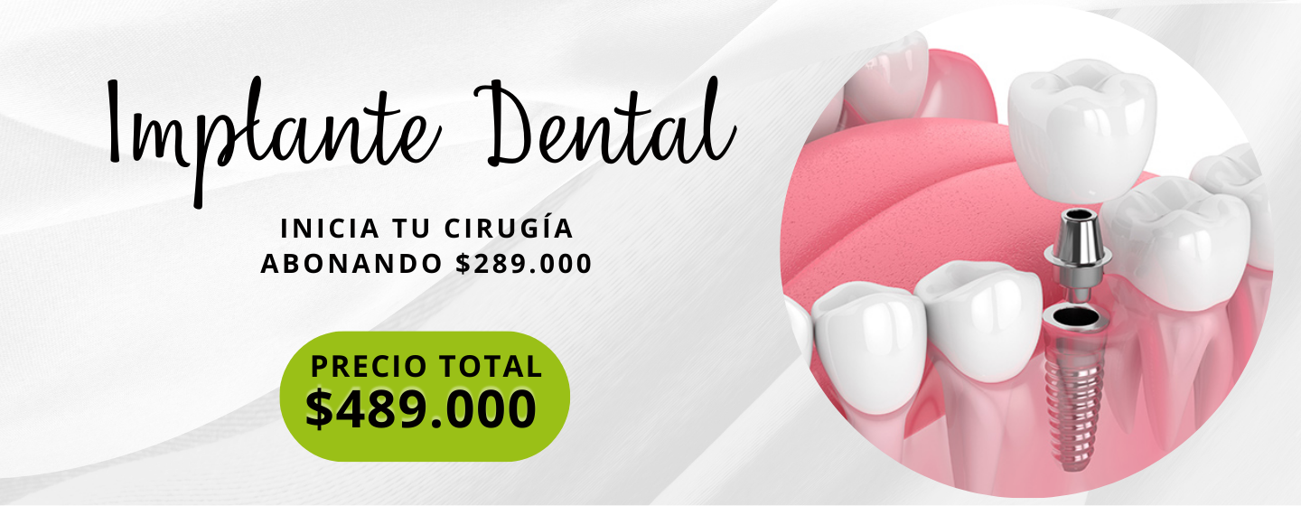 Implante Dental